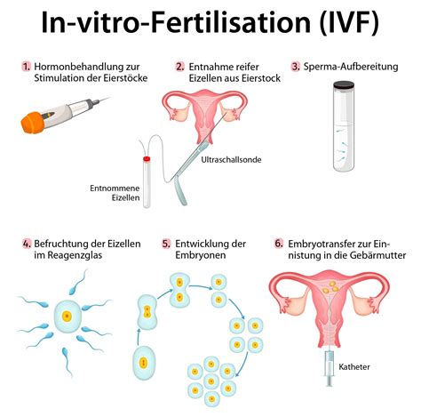 in vitro fertilisation deutsch